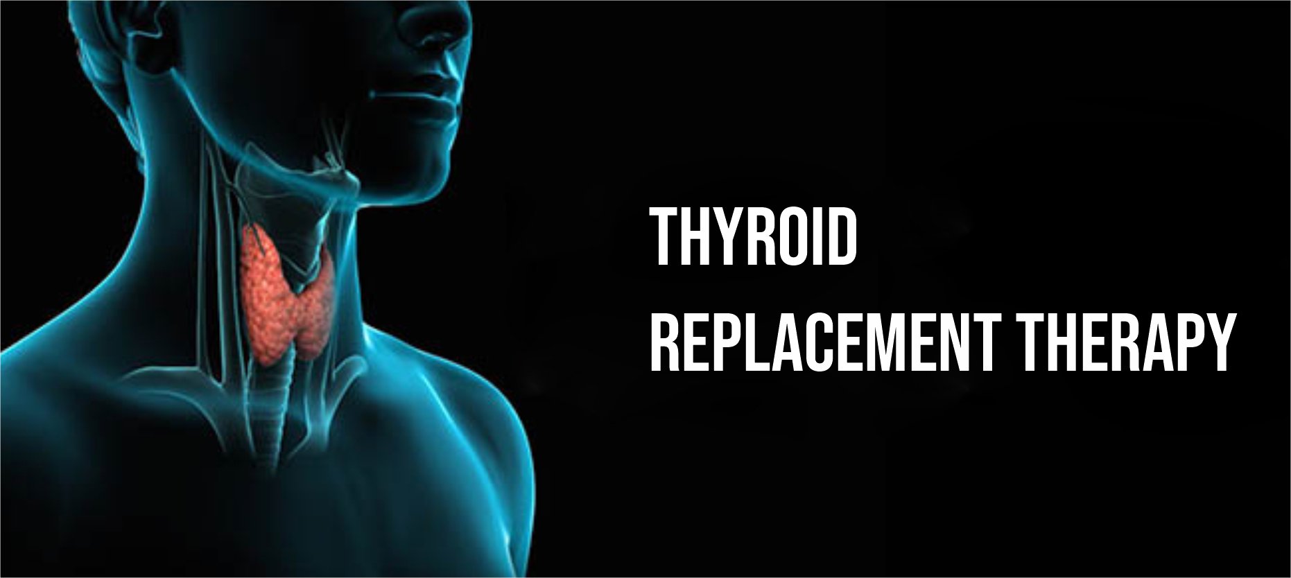 Thyroid replacement