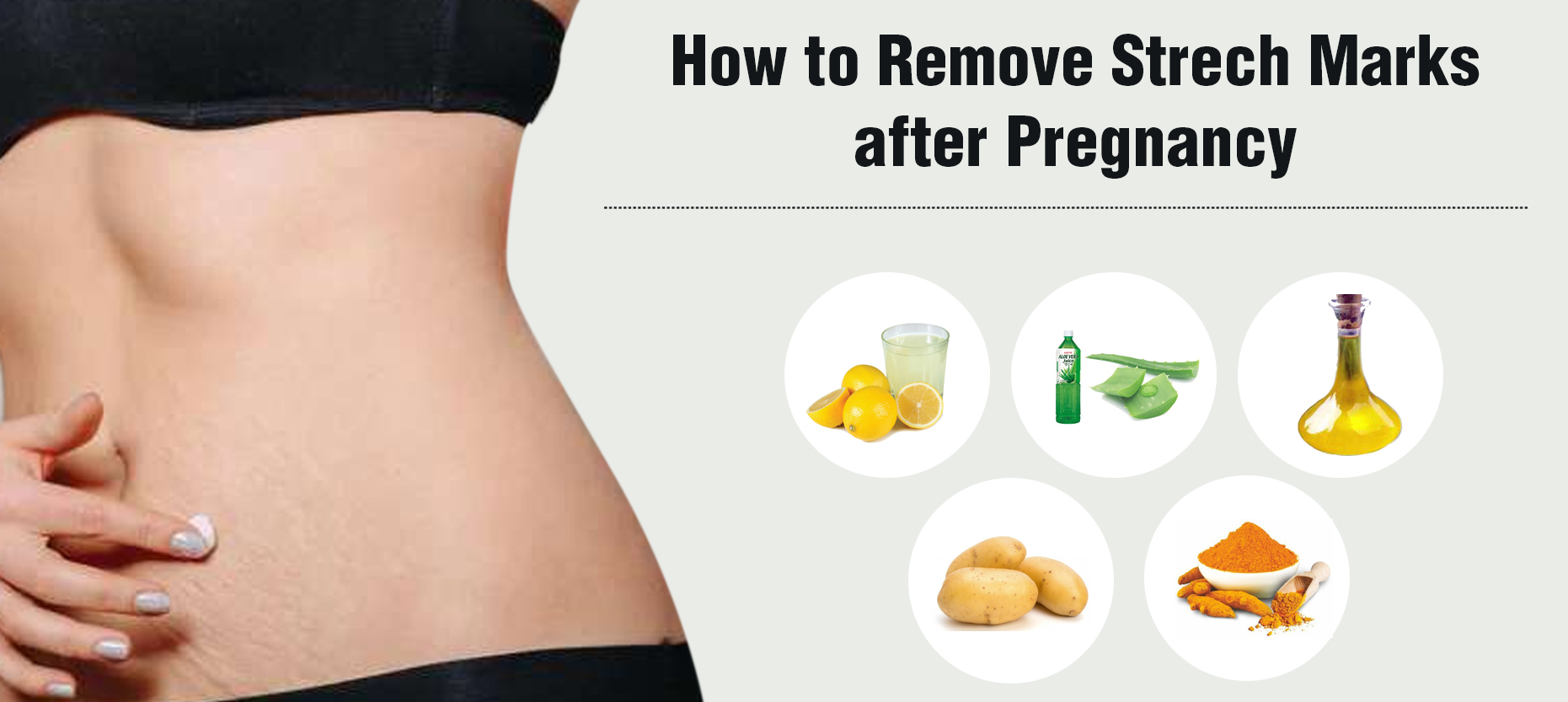 How to Remove Stretch Marks after Pregnancy