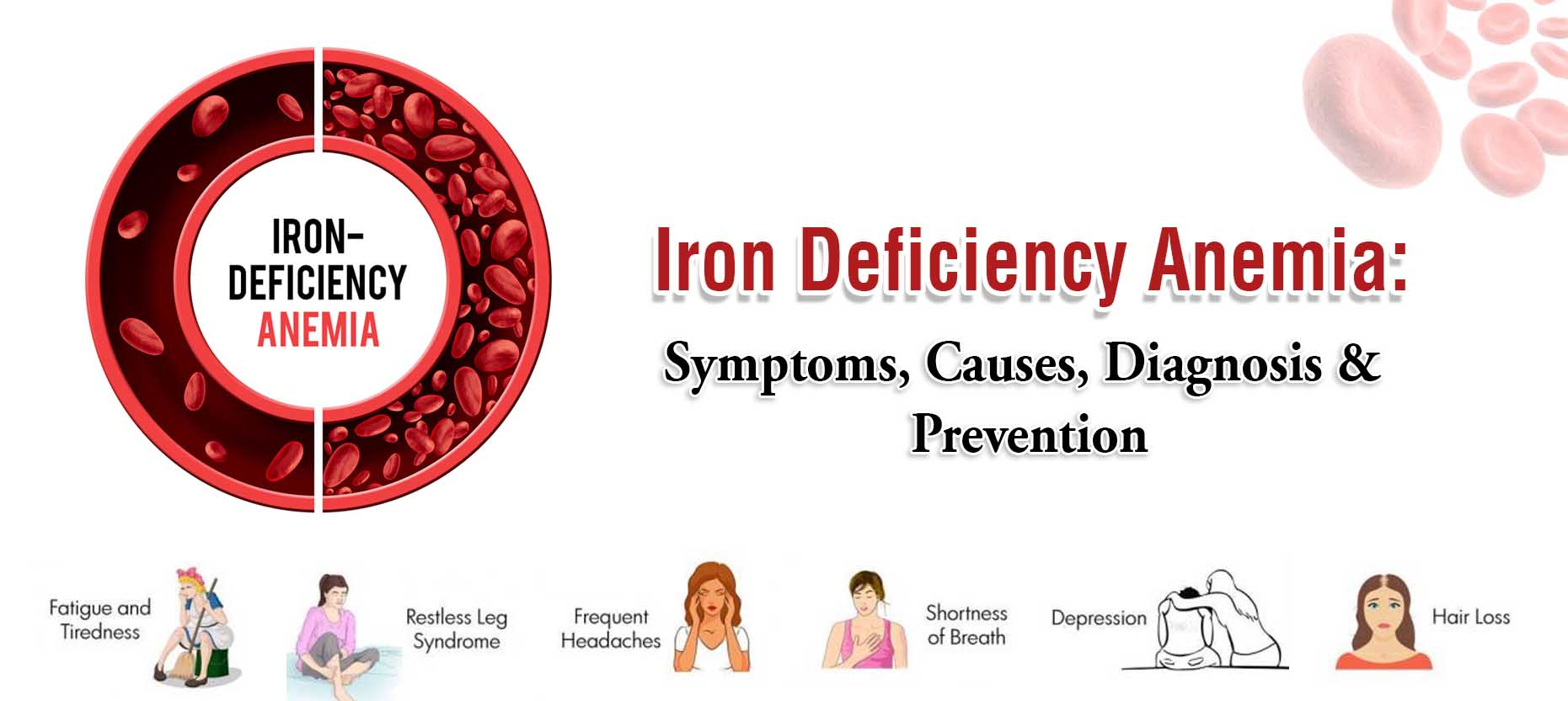 Iron Deficiency Anemia: Symptoms, Causes, Diagnosis & Prevention