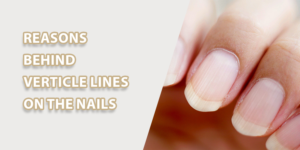 Vertical Lines On The Nails: Reasons And Treatment