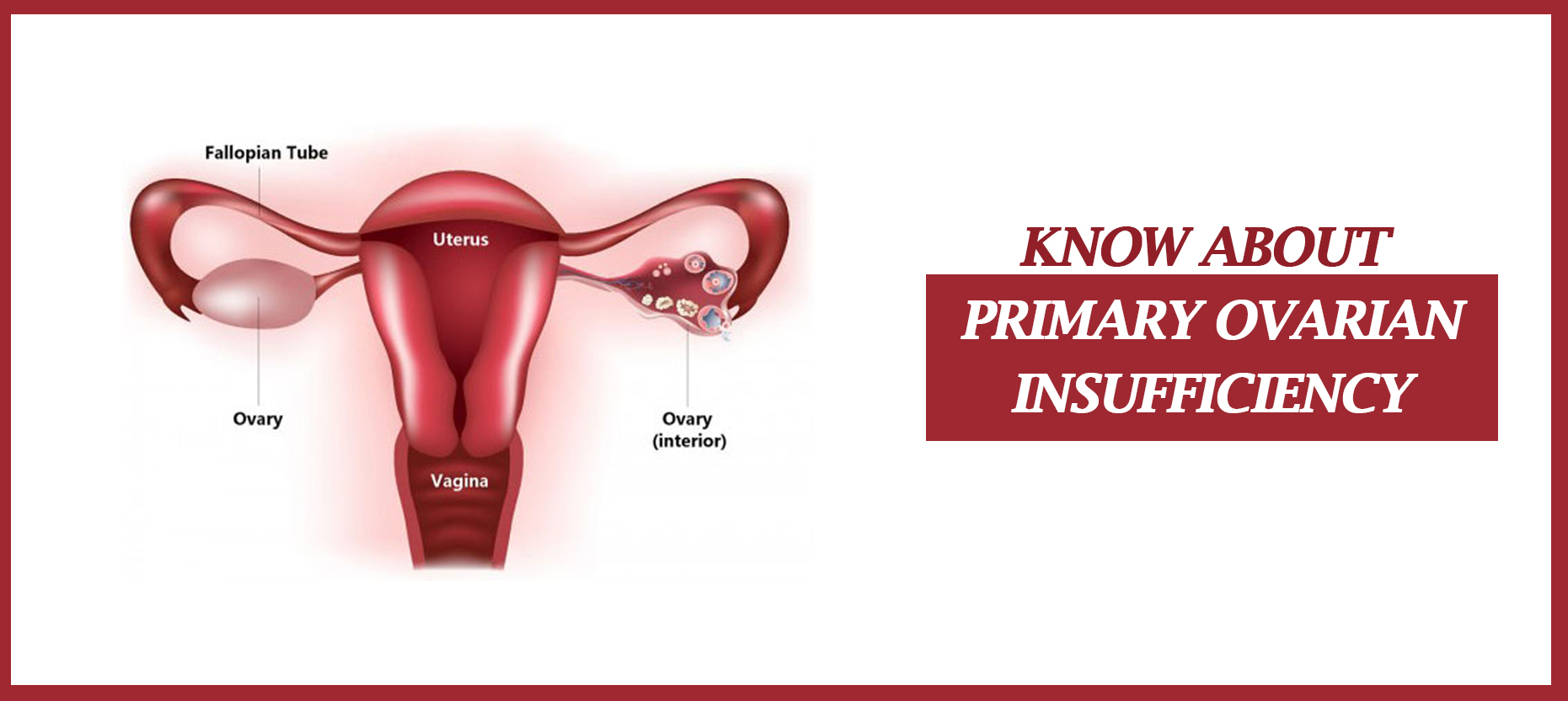 Primary Ovarian Insufficiency: Causes, Symptoms, and Management