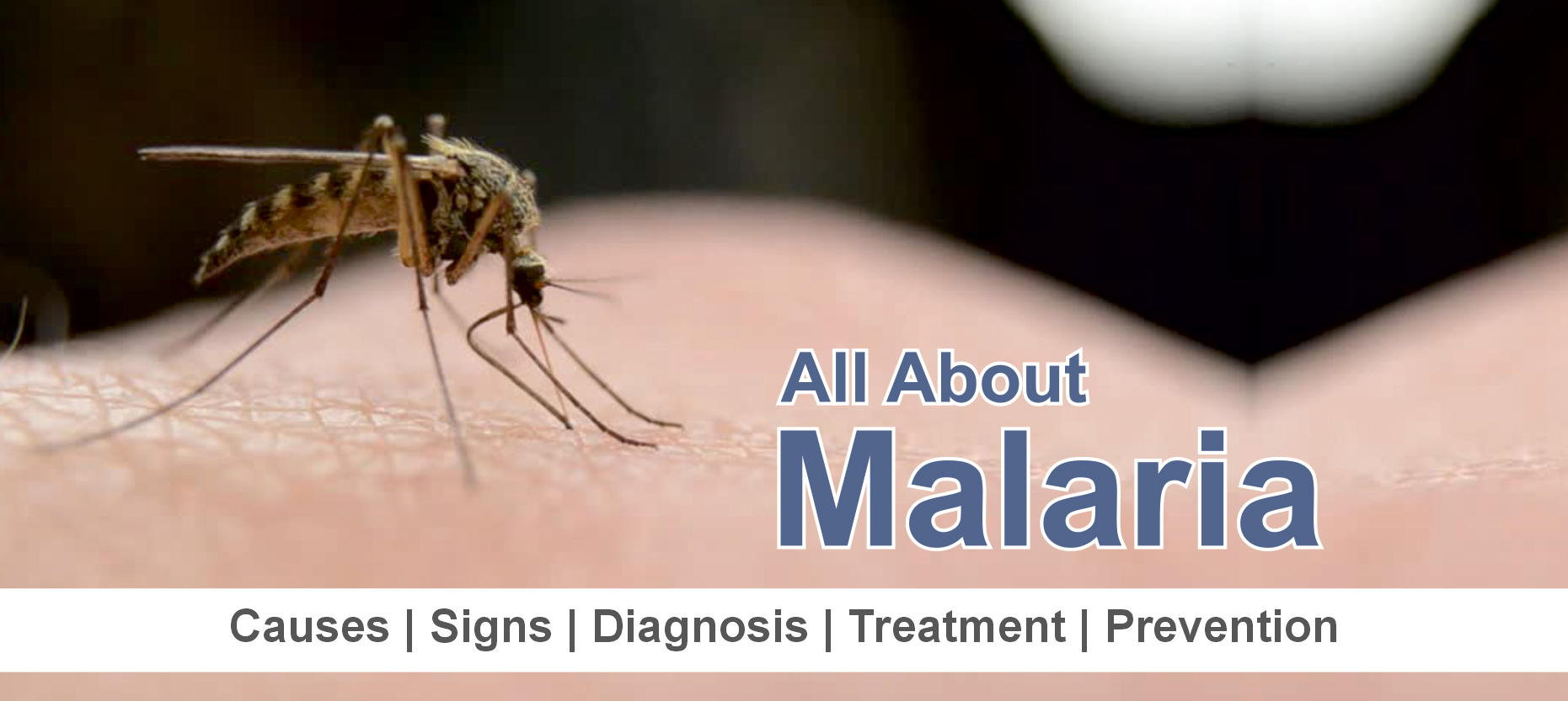 Malaria: Causes, Signs, Diagnosis, Treatment, and Prevention