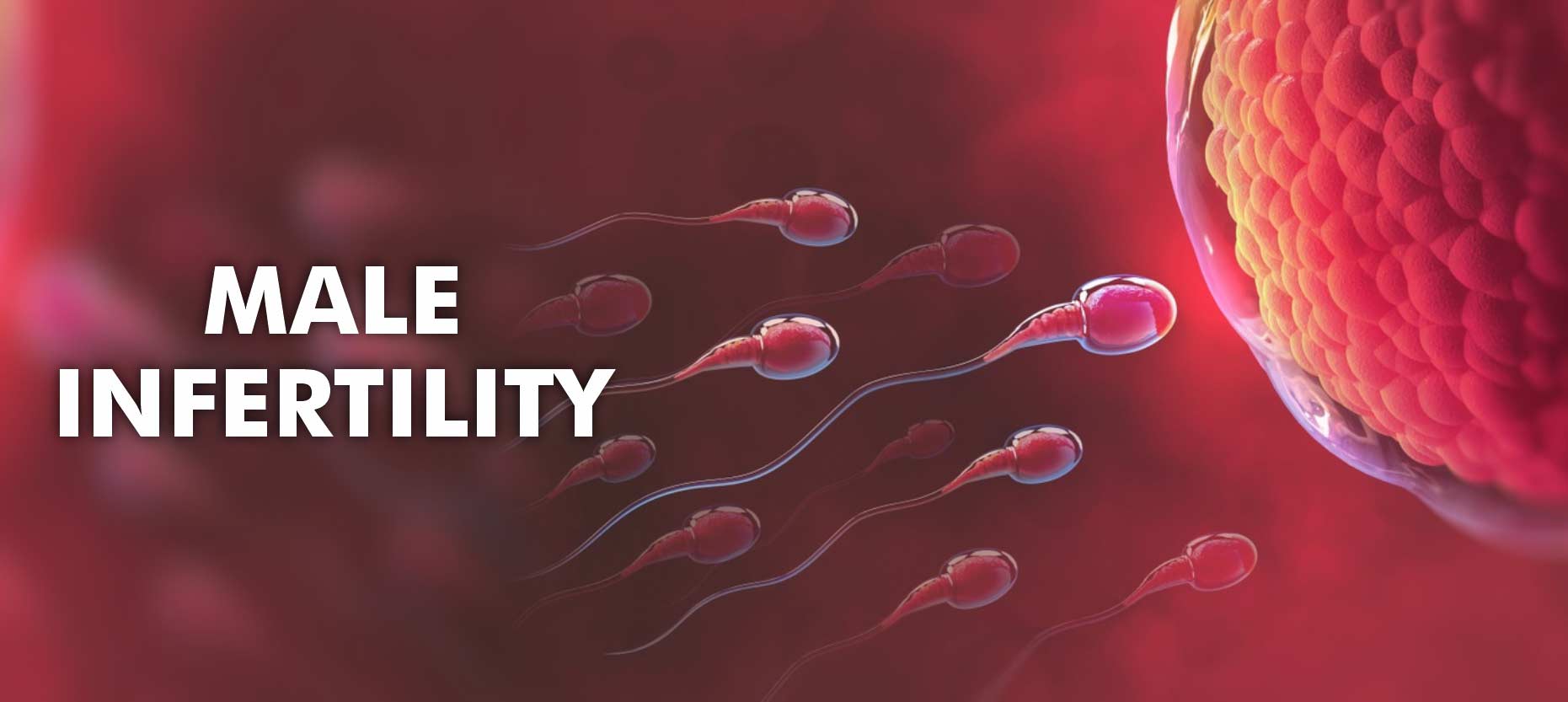 Male Infertility: Symptoms, Causes, Treatment