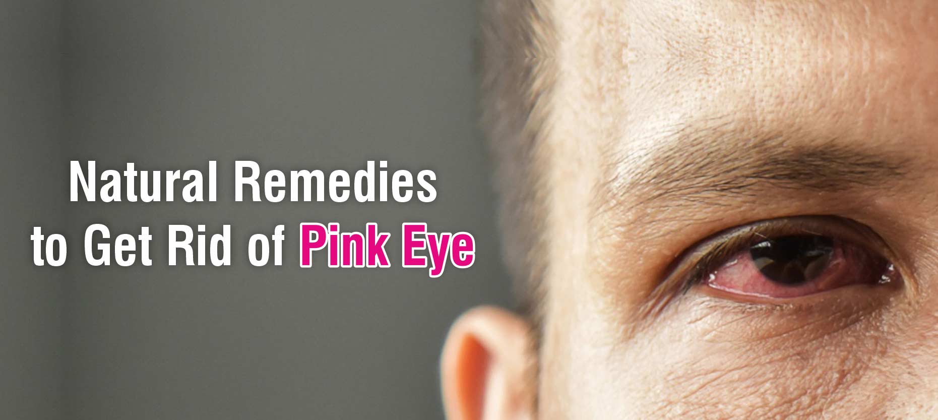 Natural Remedies to Get Rid of Pink Eye