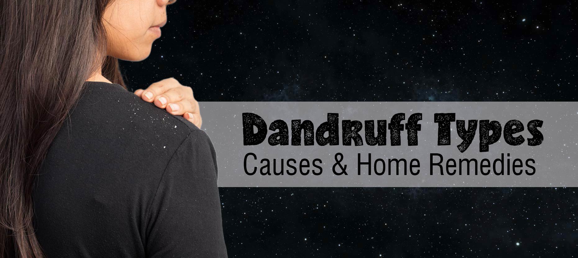 Dandruff: Types, Causes & Home Remedies