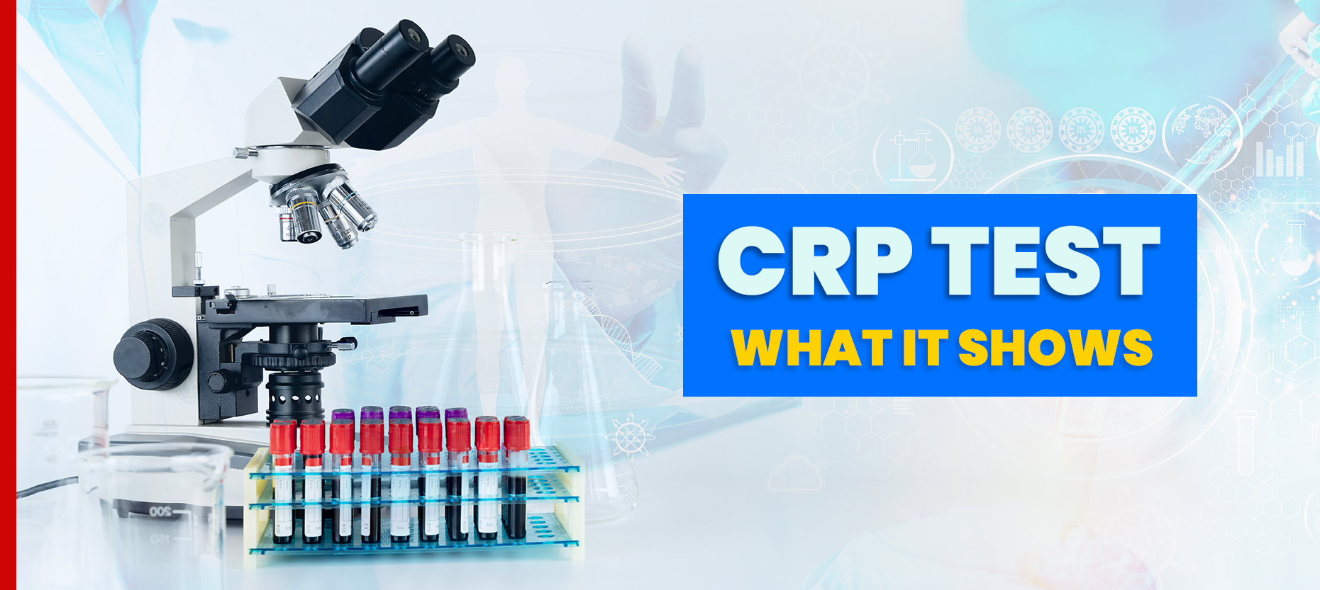 How CRP Testing Helps Detect Inflammation in the Body How CRP Testing Helps Detect Inflammation in the Body