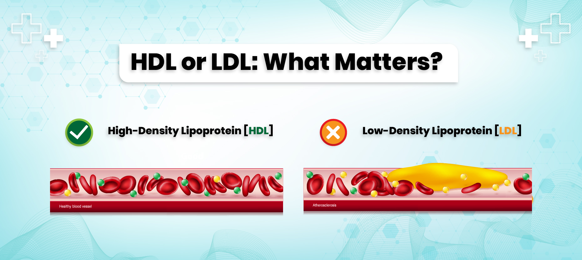 What is the Difference Between HDL & LDL Cholesterol?