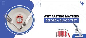 Fasting Before a Blood Test