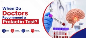 Prolactin Test