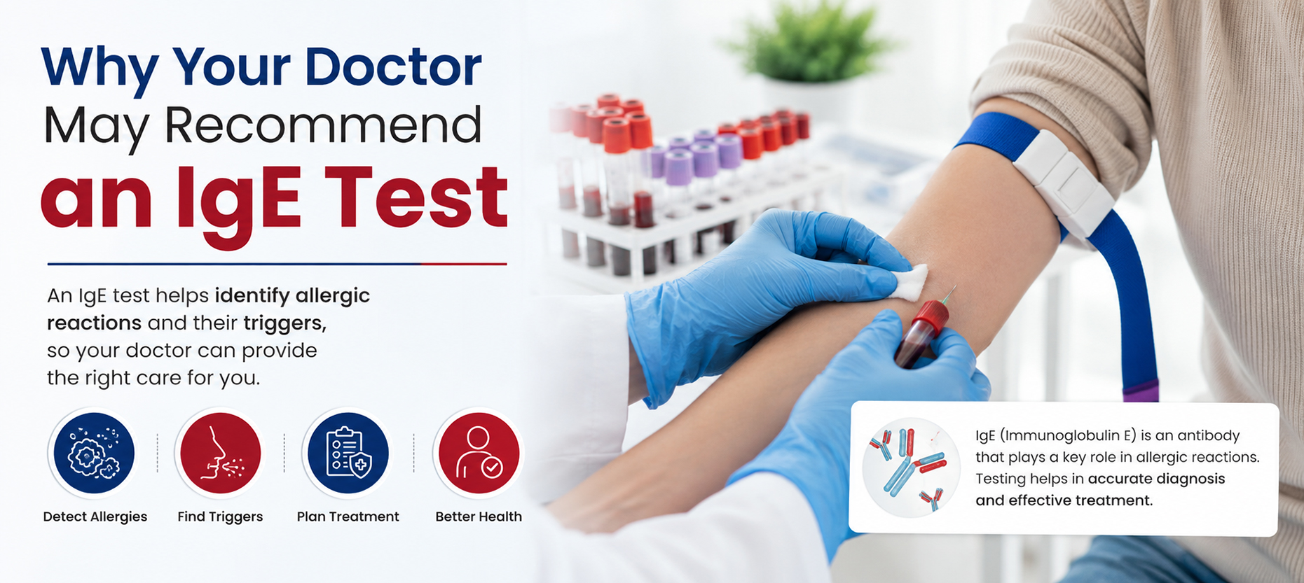 Why Your Doctor May Recommend an IgE Test
