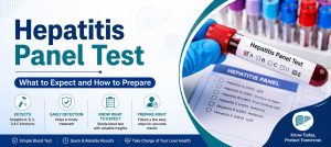 Hepatitis Panel Test
